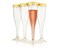 Perfect Settings 36 Pack Gold Glitter Plastic Champagne Flutes with Gold Rim | Disposable and Elegant Glasses for Parties, Weddings, and Showers